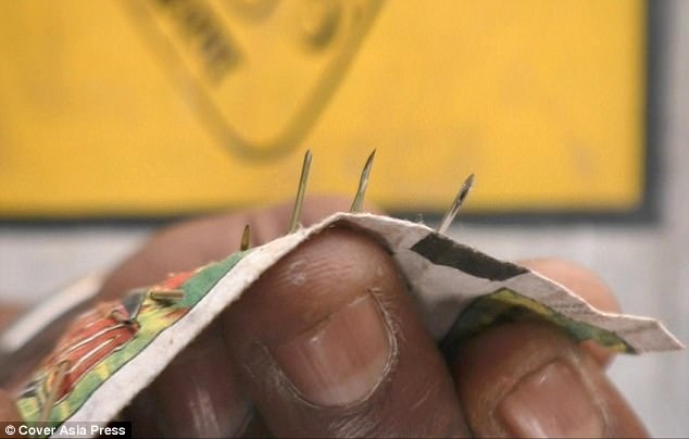 Nguoi phu nu co 70 kim tiem nam trong bap chan hinh anh