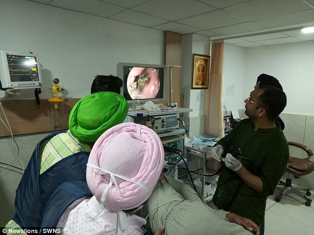 cậu bé nhai gỗ, nhựa ảnh 1 cau be nhai go, nhua anh 1