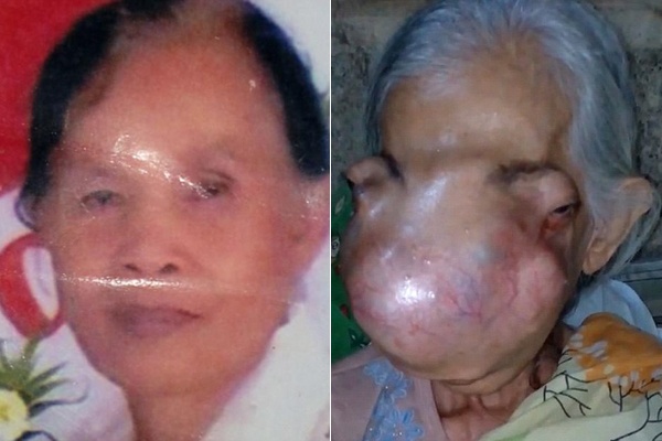 Mat bien dang vi mac u mui hinh anh