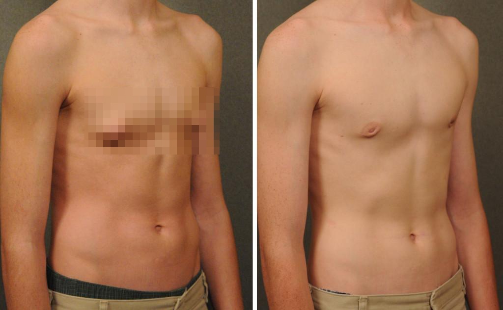 Cau be co vong mot nhu co gai 18 tuoi hinh anh