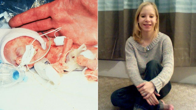 tre sinh non nhe can nhat the gioi anh 2