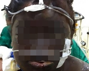 người phụ nữ bị tạt axit ảnh 1 nguoi phu nu bi tat axit anh 1