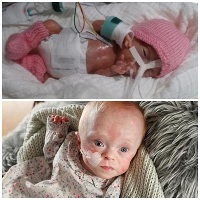 tre sinh non nhe can nhat the gioi anh 1