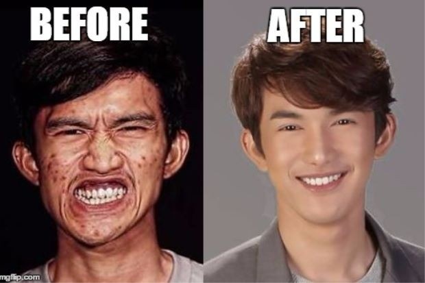 chang trai lot xac sau phau thuat tham my anh 1