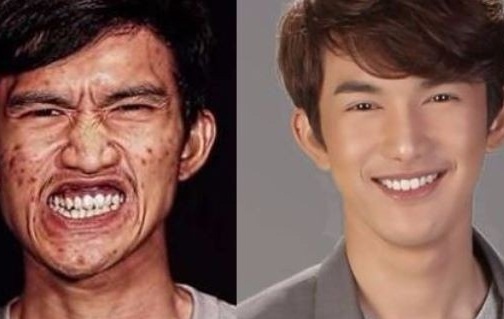 Me khong nhan ra con trai sau khi phau thuat tham my hinh anh