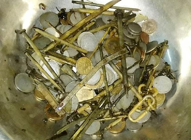 Nuot 7 kg mong tay, dinh oc, tien xu vao da day hinh anh