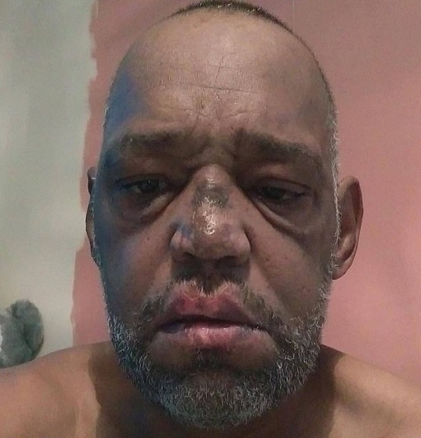 mất bàn chân sau vết cào của chó ảnh 1 mat ban chan sau vet cao cua cho anh 1