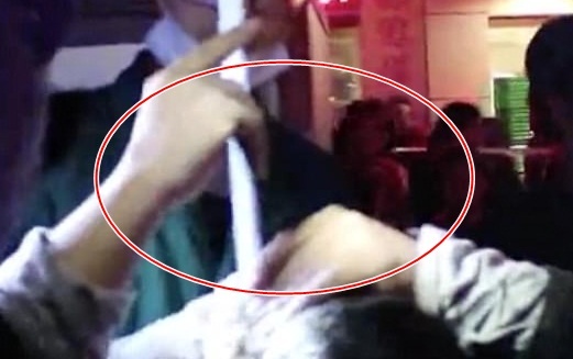 Nguoi dan ong van tinh tao sau khi bi thanh thep cam vao dau hinh anh