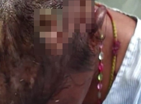 Gap hang tram con gioi tren dau nguoi phu nu 30 tuoi hinh anh