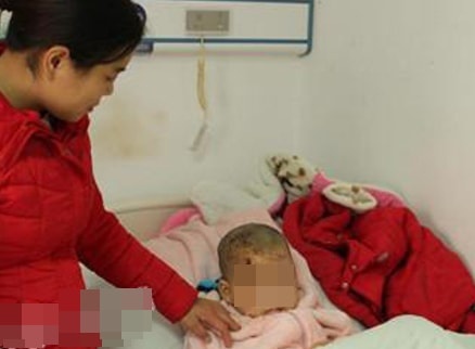 Be trai 5 tuoi phai khau 38 mui do bi cho ngao Tay Tang tan cong hinh anh