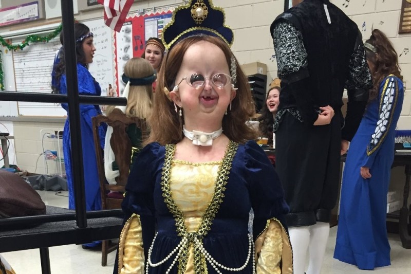 co gai mac benh hiem gap anh 1