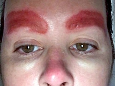 Long may ung do sau khi xam hinh anh