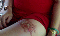 Mot phu nu bi bong dui vi dien thoai no hinh anh