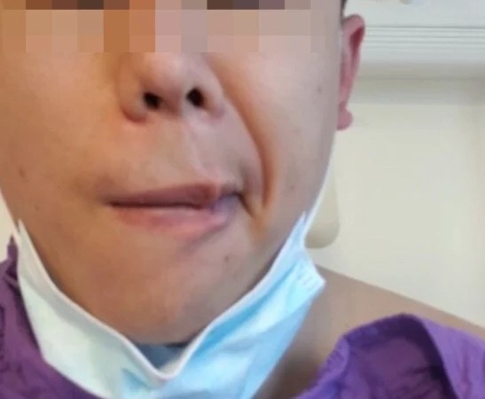 Nguoi dan ong liet mat sau khi duoc tiem vaccine cua Trung Quoc hinh anh