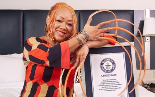 Nguoi phu nu My cat bo mong tay dai nhat the gioi hinh anh