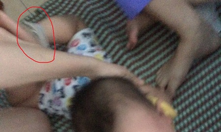 Chau be bi troi chan tay dang sot cao va hoang loan hinh anh