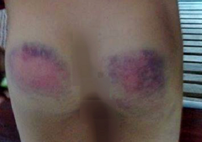 Cô giáo đánh học sinh ảnh 1 Co giao danh hoc sinh anh 1