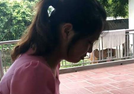 Co giao mam non dap gay xuong dui be trai hinh anh
