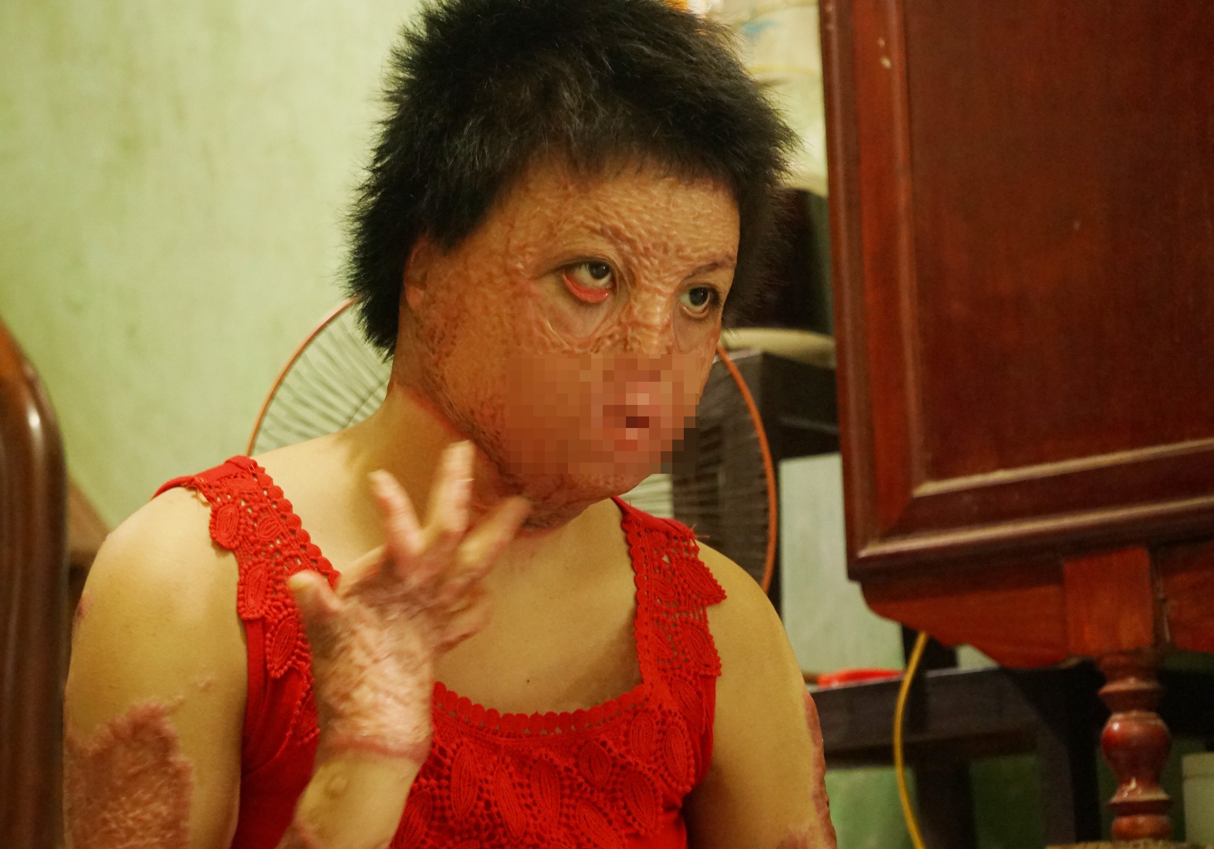 Nguoi bi chong tuoi xang dot: Con thay mat toi la khoc thet hinh anh