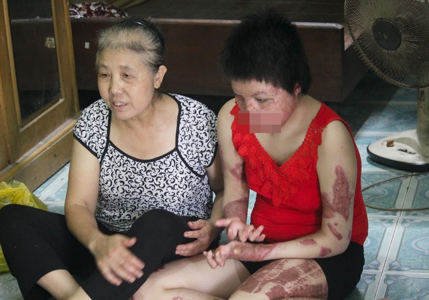 Chồng tưới xăng đốt vợ ảnh 1 Chong tuoi xang dot vo anh 1