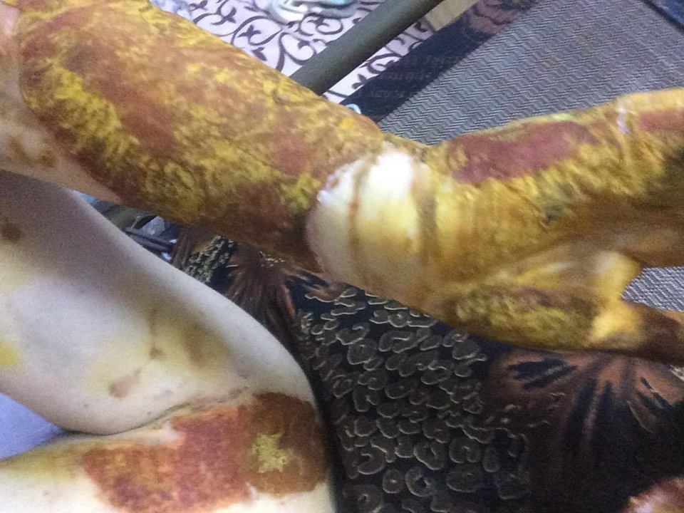 Nữ sinh bỏng nặng trong phòng thí nghiệm ảnh 1 Nu sinh bong nang trong phong thi nghiem anh 1