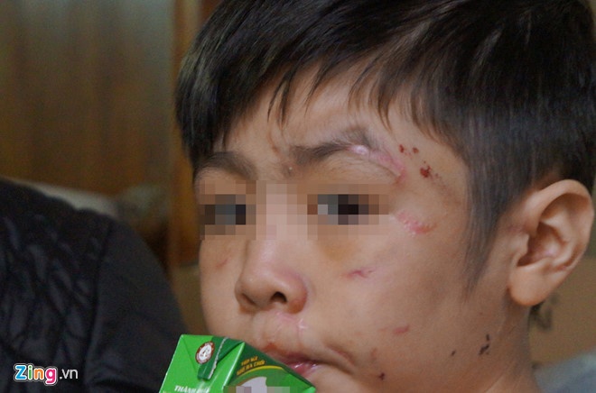 Bo bao hanh con da man anh 1