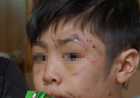 Nha truong len tieng chuyen that hoc cua be trai bi bo, me ke hanh ha hinh anh