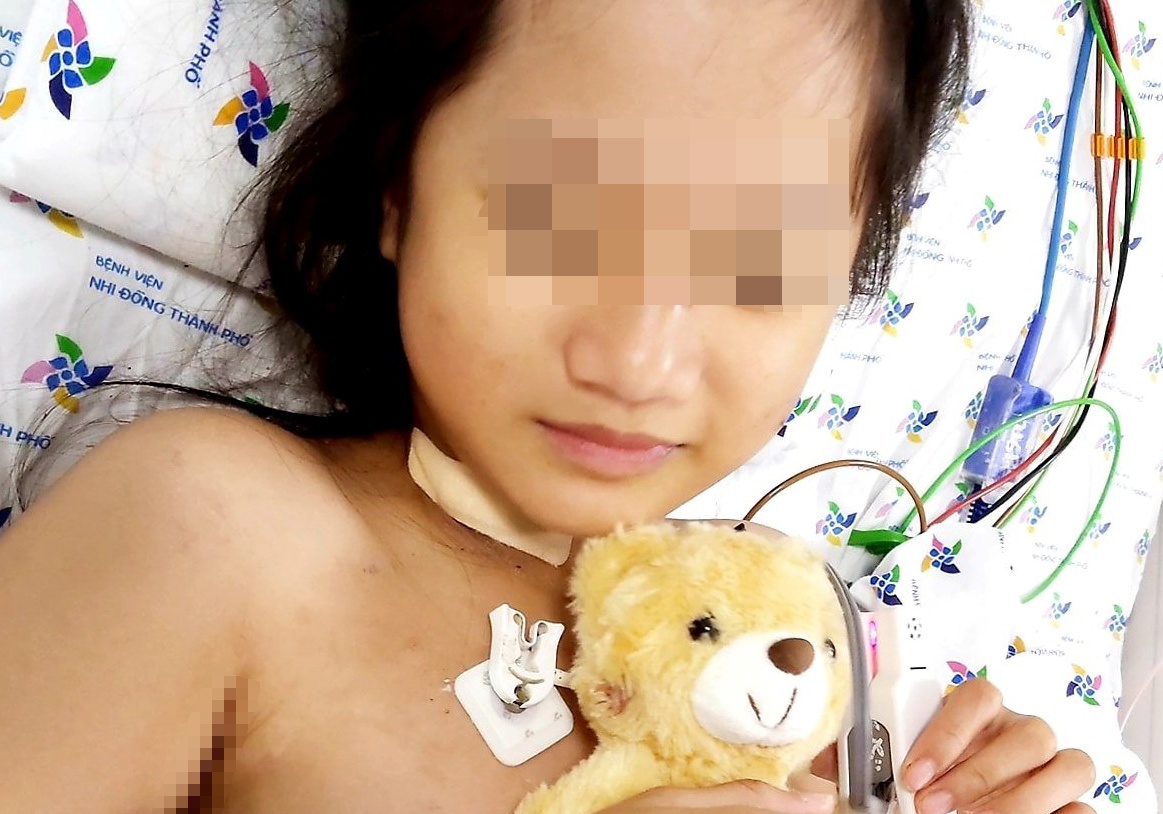 Be gai 10 tuoi nguy kich sau 3 ngay sot hinh anh