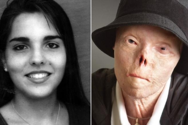 Co gai bi huy hoai guong mat vi tai xe say xin qua doi o tuoi 40 hinh anh