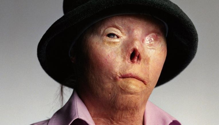 bieu tuong chong lai xe say xin qua doi anh 2