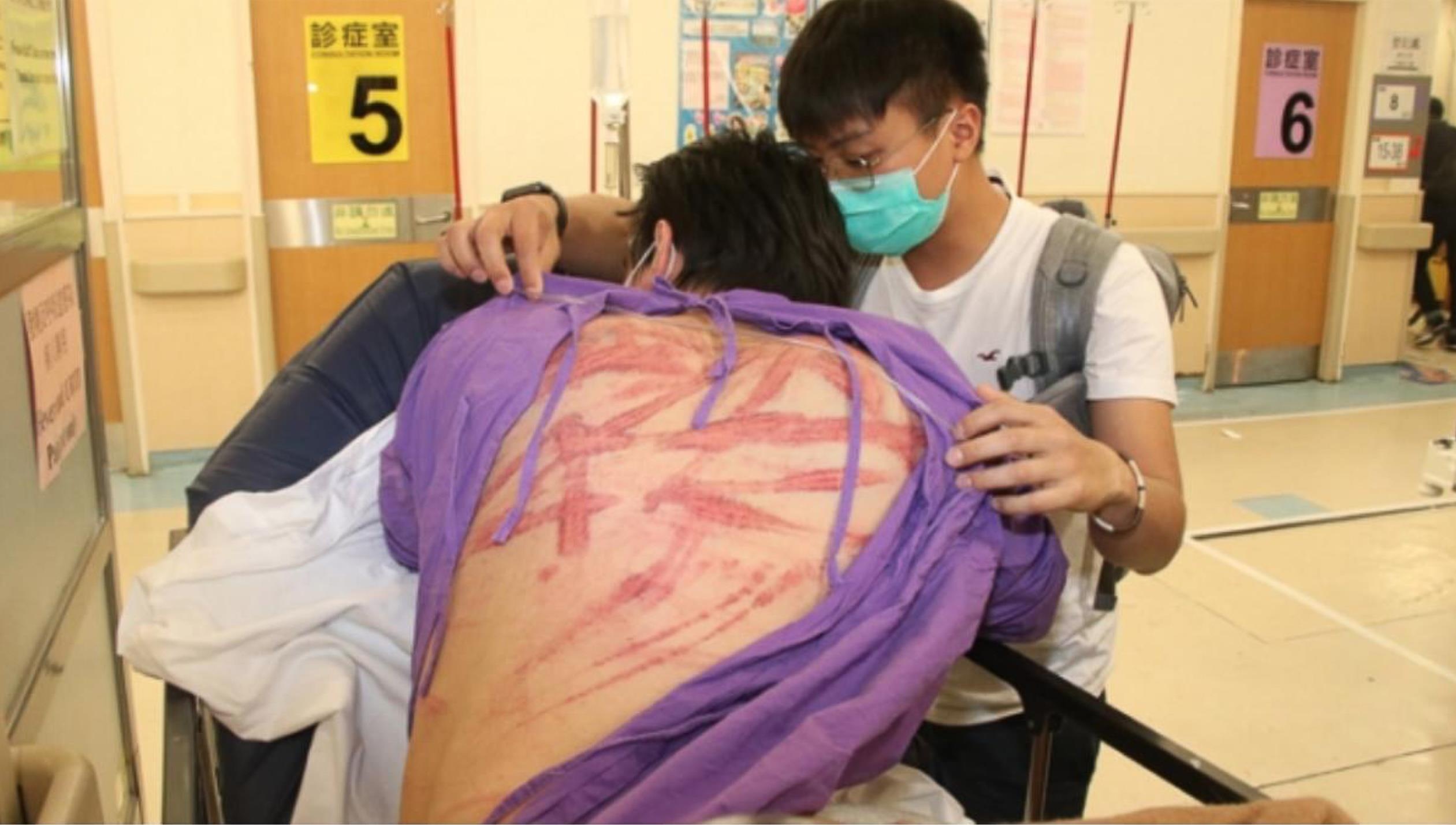 hoi Tam Hoang danh nguoi bieu tinh Hong Kong anh 4