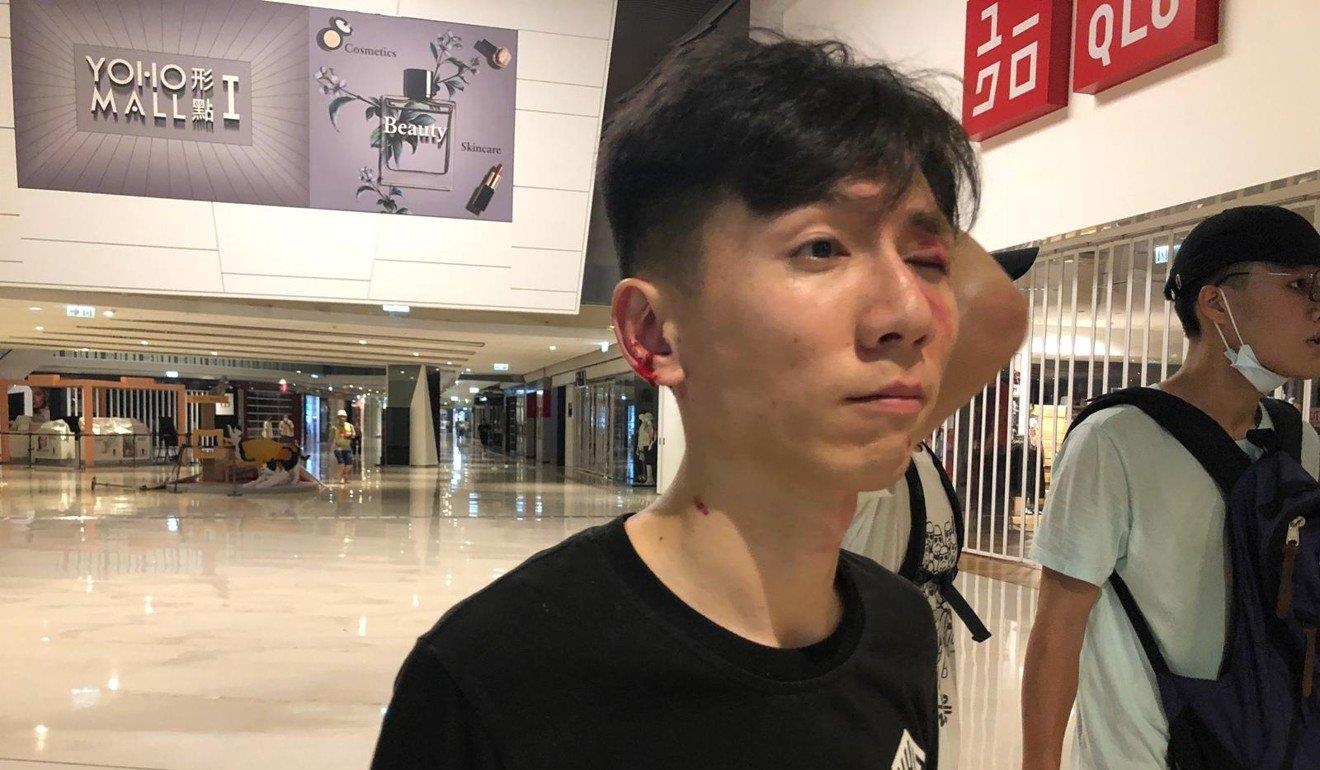 hoi Tam Hoang danh nguoi bieu tinh Hong Kong anh 3