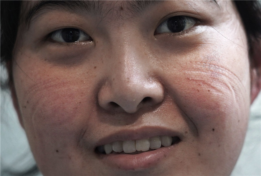 y-bac si noi tuyen dau chong virus corona anh 2