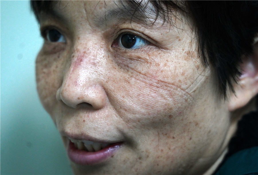 Vet han tren guong mat nhung y-bac si tuyen dau chong virus corona hinh anh