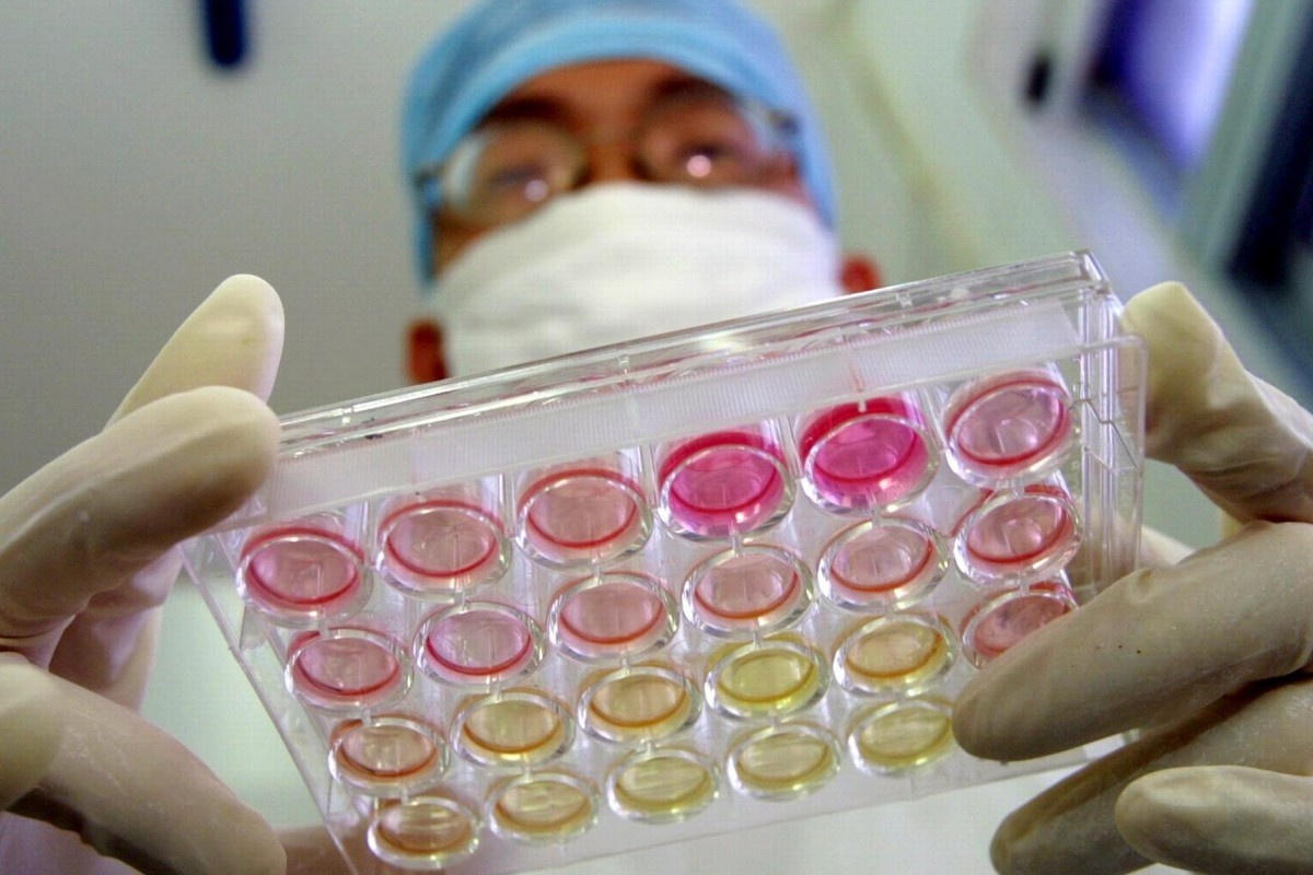 'Virus co the da lay tren nguoi nhieu thap ky moi bung phat o Vu Han' hinh anh