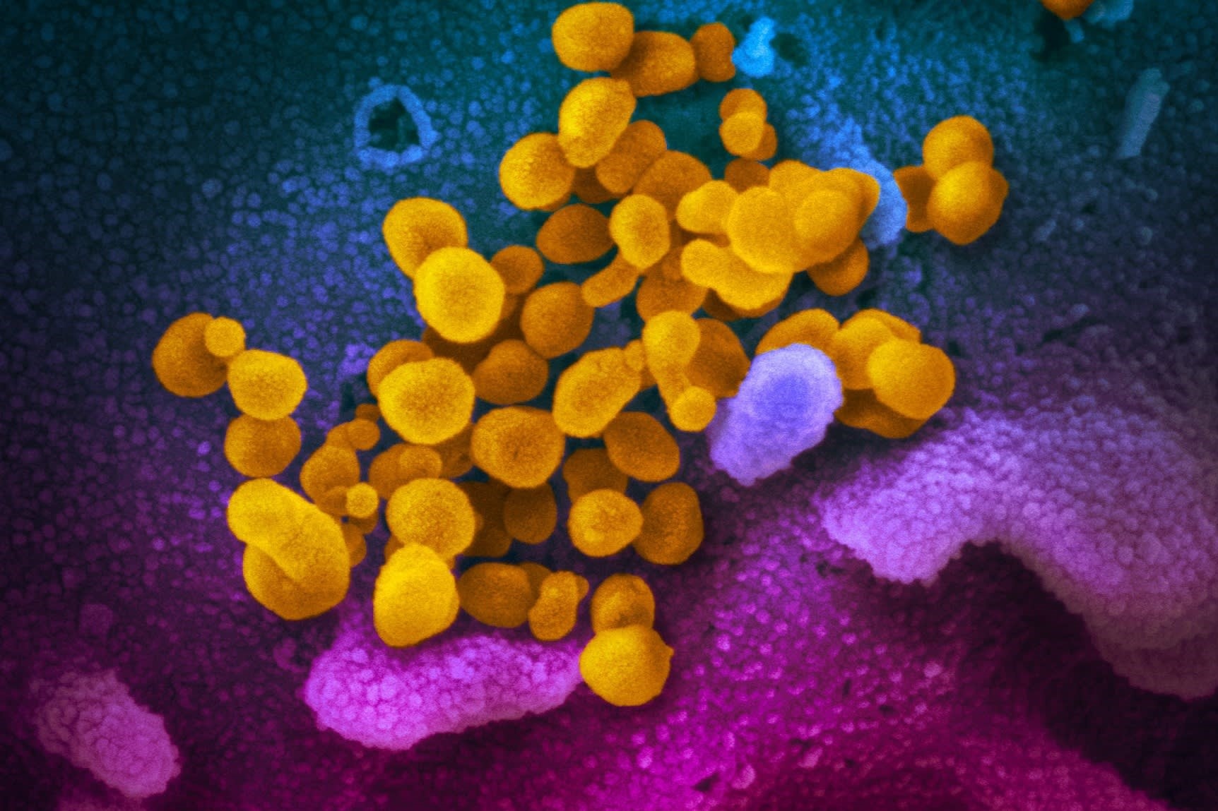 Nghien cuu moi: Virus corona lay lan khap the gioi tu cuoi nam 2019 hinh anh