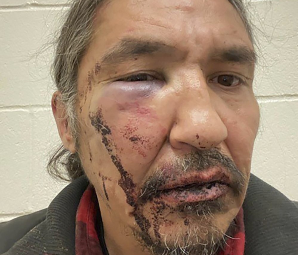 Video canh sat danh thu linh tho dan gay rung dong Canada hinh anh