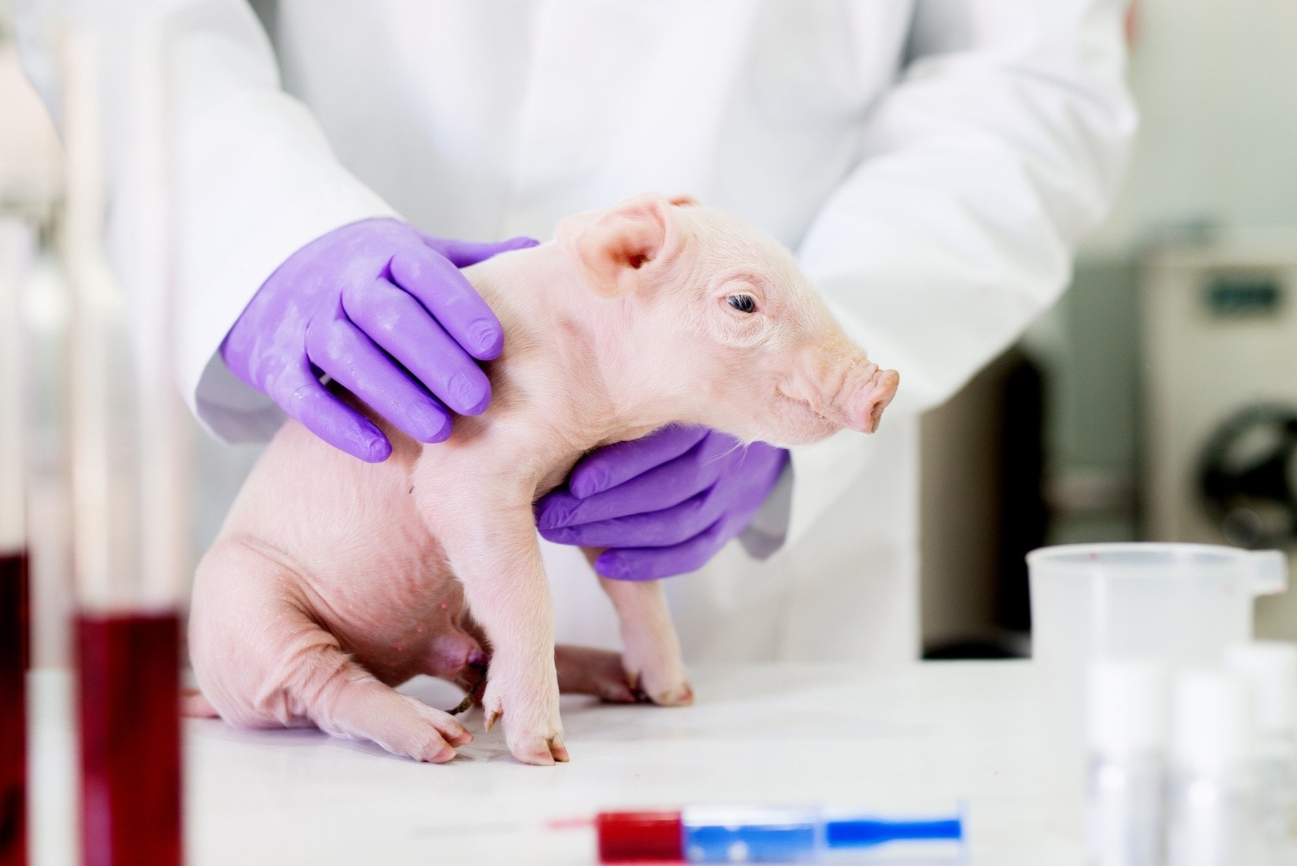 Cac nha khoa hoc TQ muon hien thuc hoa ghep tang lon cho nguoi hinh anh