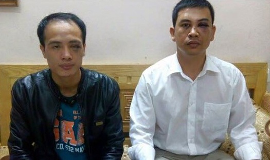 Khoi to vu 2 luat su bi hanh hung hinh anh