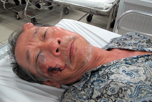 Nguoi dan ong tat nguyen o Sai Gon bi cuop 40 to ve so hinh anh