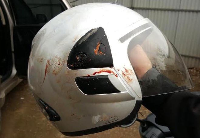 Nhà báo Đỗ Doãn Hoàng bị hành hung ảnh 1 Nha bao Do Doan Hoang bi hanh hung anh 1