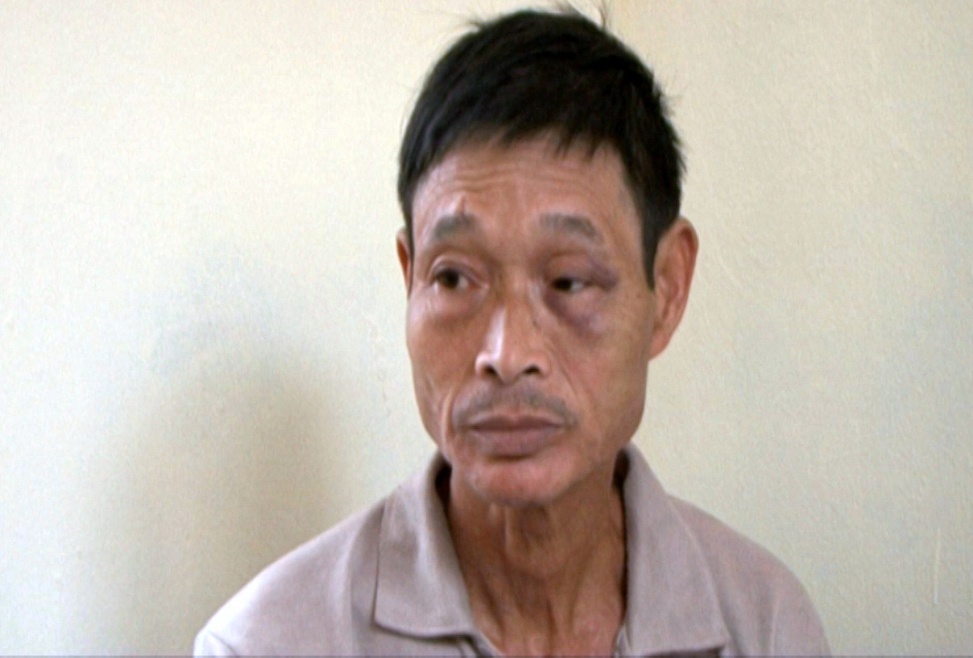 Giai cuu chau noi, nguoi dan ong bi dieu tra toi giet nguoi hinh anh