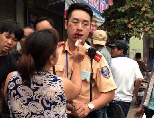Khoi to thanh nien 9X dam CSGT gay 2 rang hinh anh