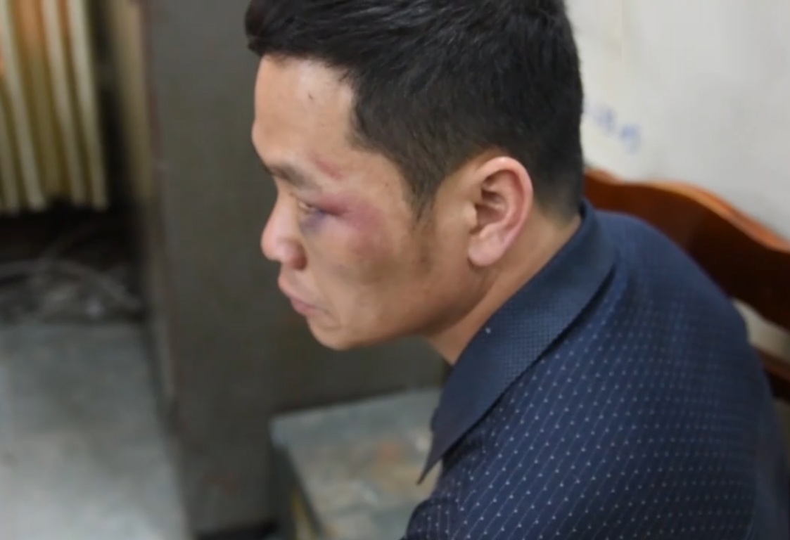 Tai xe Fortuner cho 100 banh heroin bi khoi to hinh anh