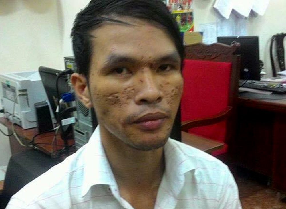 Truy to ke hanh ha be trai Campuchia bang roi dien hinh anh