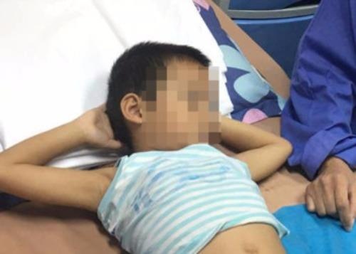 Khoi to dieu tra vu 79 tre mac sui mao ga o Hung Yen hinh anh