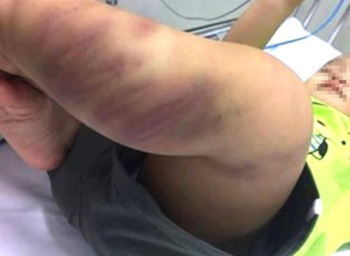 Canh sat tim ra nguoi nuoi be trai 1 tuoi nghi bi bao hanh hinh anh