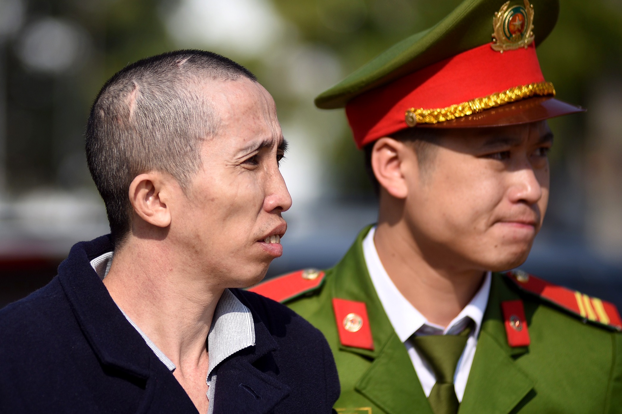Ke bi cao buoc siet co co gai giao ga phan cung hinh anh