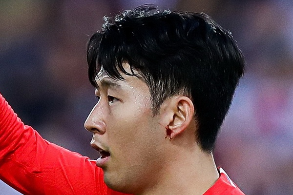 Son Heung-min rach tai trong chien thang cua tuyen Han Quoc hinh anh