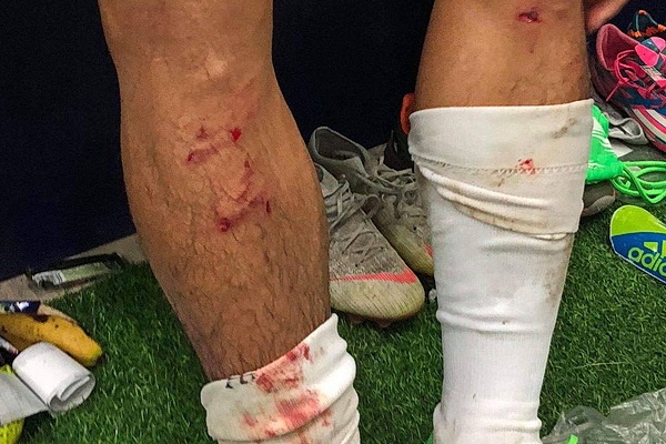 ‘Van Kien co 4 vet giay o ong dong, Que Ngoc Hai dang nhan the do’ hinh anh